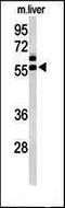 Epithelial Cell Adhesion Molecule antibody, orb312226, Biorbyt, Western Blot image 