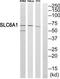 GAT-1 antibody, TA314542, Origene, Western Blot image 