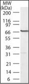 Polo Like Kinase 1 antibody, orb95363, Biorbyt, Western Blot image 