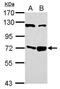 Acyl-CoA Synthetase Long Chain Family Member 1 antibody, PA5-29506, Invitrogen Antibodies, Western Blot image 