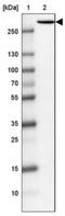 Inositol 1,4,5-Trisphosphate Receptor Type 1 antibody, NBP1-83105, Novus Biologicals, Western Blot image 