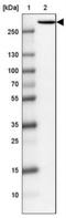 Inositol 1,4,5-trisphosphate receptor type 1 antibody, NBP1-83105, Novus Biologicals, Western Blot image 