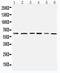 Pyruvate Dehydrogenase Kinase 1 antibody, PA5-79798, Invitrogen Antibodies, Western Blot image 