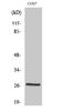 Heat Shock Protein Family B (Small) Member 1 antibody, STJ90294, St John