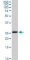 EF-Hand Domain Family Member D1 antibody, H00080303-M05, Novus Biologicals, Western Blot image 