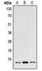 RNA Polymerase II Subunit I antibody, LS-C352682, Lifespan Biosciences, Western Blot image 