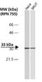 Cyclin Dependent Kinase 4 antibody, NB120-6315, Novus Biologicals, Western Blot image 