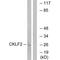 CKLF Like MARVEL Transmembrane Domain Containing 2 antibody, A12942, Boster Biological Technology, Western Blot image 