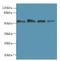 Gasdermin D antibody, LS-C375837, Lifespan Biosciences, Western Blot image 