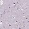 Phenylalanine Hydroxylase antibody, PA5-56807, Invitrogen Antibodies, Immunohistochemistry paraffin image 