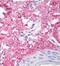 Collagen Type V Alpha 1 Chain antibody, 90008, QED Bioscience, Immunohistochemistry paraffin image 