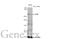 ATM Serine/Threonine Kinase antibody, GTX635395, GeneTex, Western Blot image 