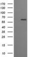 Chaperonin Containing TCP1 Subunit 8 Like 2 antibody, NBP2-46114, Novus Biologicals, Western Blot image 