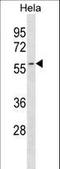 AUP1 Lipid Droplet Regulating VLDL Assembly Factor antibody, LS-C156688, Lifespan Biosciences, Western Blot image 