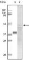 Glycogen Synthase Kinase 3 Alpha antibody, abx010857, Abbexa, Enzyme Linked Immunosorbent Assay image 