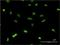 M31 antibody, H00010951-M01, Novus Biologicals, Immunocytochemistry image 