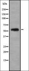 Collagen Type IX Alpha 1 Chain antibody, orb337700, Biorbyt, Western Blot image 