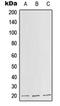 Solute Carrier Family 25 Member 11 antibody, orb214782, Biorbyt, Western Blot image 