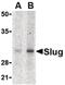 Snail Family Transcriptional Repressor 2 antibody, PA5-20289, Invitrogen Antibodies, Western Blot image 