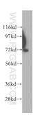Serpin Family A Member 10 antibody, 11851-1-AP, Proteintech Group, Western Blot image 