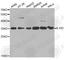 Interleukin 1 Receptor Type 2 antibody, A1899, ABclonal Technology, Western Blot image 