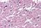 Cysteinyl Leukotriene Receptor 2 antibody, NBP1-02340, Novus Biologicals, Immunohistochemistry frozen image 