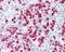 S100 Calcium Binding Protein A8 antibody, GTX16249, GeneTex, Immunohistochemistry paraffin image 