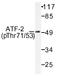 Activating Transcription Factor 2 antibody, AP01531PU-N, Origene, Western Blot image 