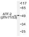 CREB2 antibody, AP01531PU-N, Origene, Western Blot image 