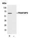 TRAF3 Interacting Protein 3 antibody, LS-C353565, Lifespan Biosciences, Immunoprecipitation image 