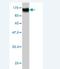 RAP1 GTPase Activating Protein antibody, H00005909-M01, Novus Biologicals, Western Blot image 