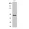 CCAAT Enhancer Binding Protein Alpha antibody, LS-C382345, Lifespan Biosciences, Western Blot image 