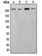 SWI/SNF Related, Matrix Associated, Actin Dependent Regulator Of Chromatin, Subfamily A, Member 2 antibody, orb214590, Biorbyt, Western Blot image 