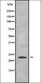 Ras Homolog Family Member G antibody, orb378398, Biorbyt, Western Blot image 