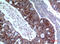 Interleukin 1 Receptor Type 2 antibody, A03106-3, Boster Biological Technology, Immunohistochemistry frozen image 