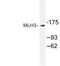 MutL Homolog 3 antibody, PA5-75345, Invitrogen Antibodies, Western Blot image 