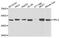 Ribosomal Protein L4 antibody, A5886, ABclonal Technology, Western Blot image 