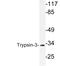 Serine Protease 3 antibody, LS-C200038, Lifespan Biosciences, Western Blot image 