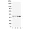 Protein C, Inactivator Of Coagulation Factors Va And VIIIa antibody, R30767, NSJ Bioreagents, Western Blot image 