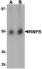 Ring Finger Protein 8 antibody, PA5-20961, Invitrogen Antibodies, Western Blot image 