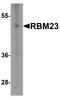 RNA Binding Motif Protein 23 antibody, A13166, Boster Biological Technology, Western Blot image 