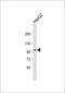 Fibroblast Growth Factor Receptor 4 antibody, 63-088, ProSci, Western Blot image 