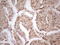 Cyclin Dependent Kinase Like 1 antibody, LS-C339717, Lifespan Biosciences, Immunohistochemistry paraffin image 