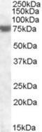 Fem-1 Homolog A antibody, NBP1-36956, Novus Biologicals, Western Blot image 