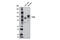 Toll Like Receptor 6 antibody, 12717S, Cell Signaling Technology, Western Blot image 