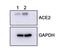 Angiotensin I Converting Enzyme 2 antibody, NBP2-67692, Novus Biologicals, Western Blot image 