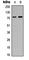 Mitogen-Activated Protein Kinase Kinase Kinase 1 antibody, abx133121, Abbexa, Western Blot image 