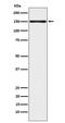 Calsyntenin 1 antibody, M07157, Boster Biological Technology, Western Blot image 