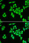 Adenylosuccinate Lyase antibody, 22-098, ProSci, Immunofluorescence image 