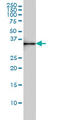 Serine Dehydratase Like antibody, LS-B4545, Lifespan Biosciences, Western Blot image 